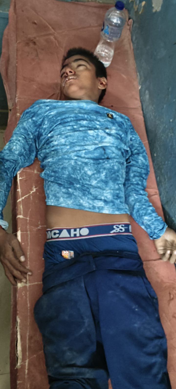 रेलवे ओवरब्रिज पर बाइक फिसलने से दो किशोर घायल, जिला अस्पताल रेफर ढाबा संचालक किशोर को घर पहुंचाने जा रहा था, रास्ते में बाइक पर सवार हुआ उसका भाई